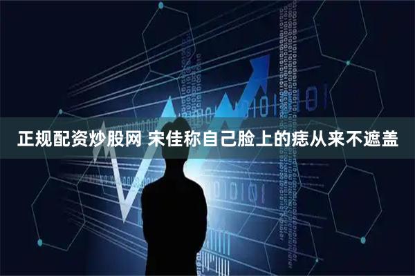 正规配资炒股网 宋佳称自己脸上的痣从来不遮盖